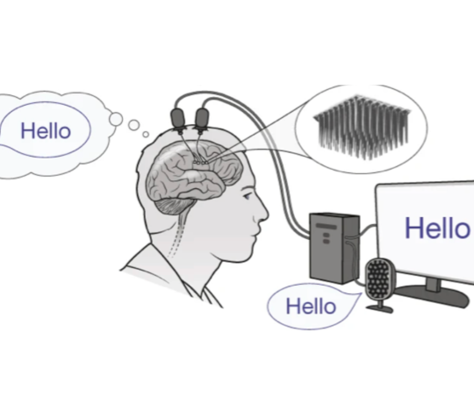 Modernās tehnoloģijas tulko neironu darbību skaņas vai teksta formā
