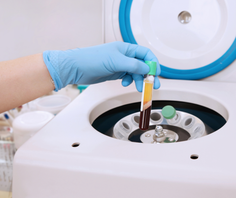 Latvijā un Eiropā ir asins plazmas deficīts