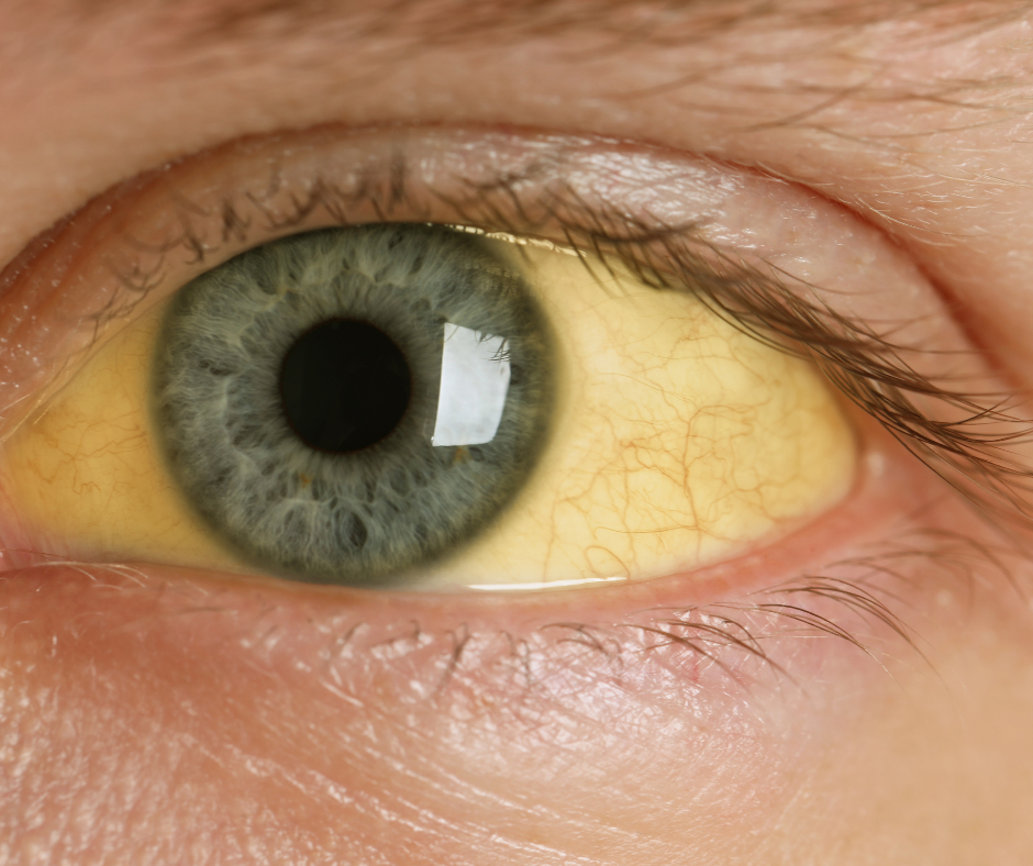 Latvijā C hepatīta un HIV infekcijas saslimstības rādītāji diemžēl ir vieni no augstākajiem ES