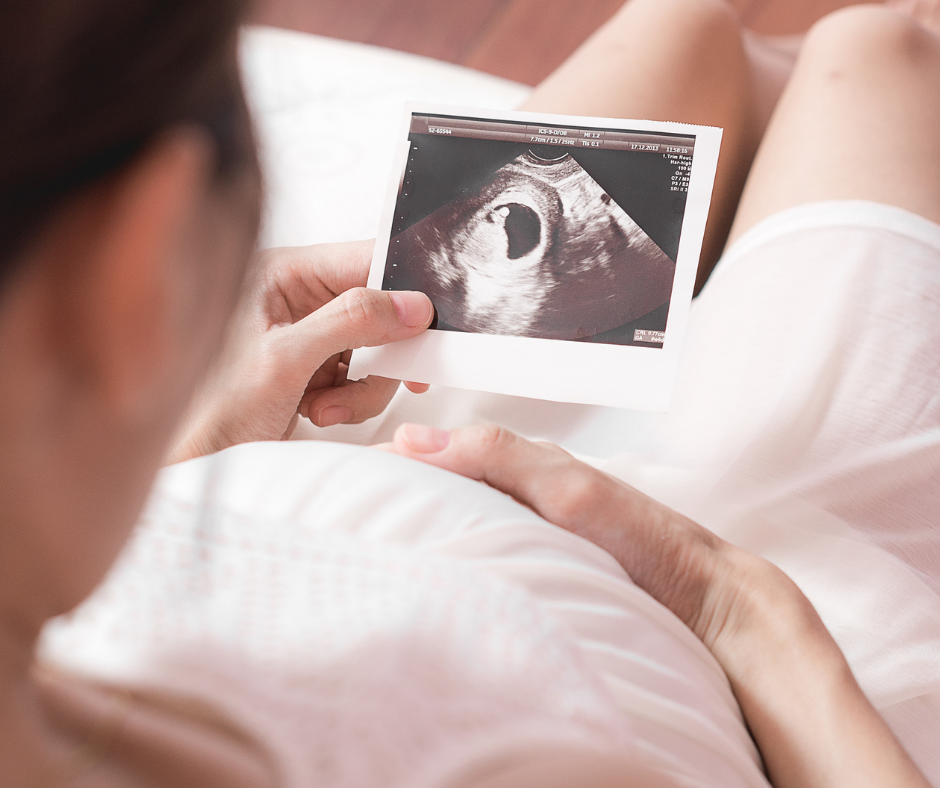 Gaidāmā mazuļa kustības grūtniecības laikā 