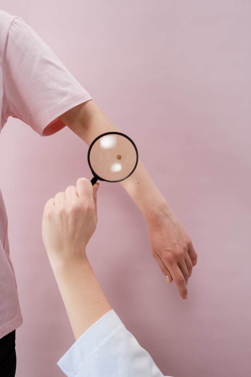 Melanomas ārstēšanā vājie posmi – diagnostika un zāļu kompensācija