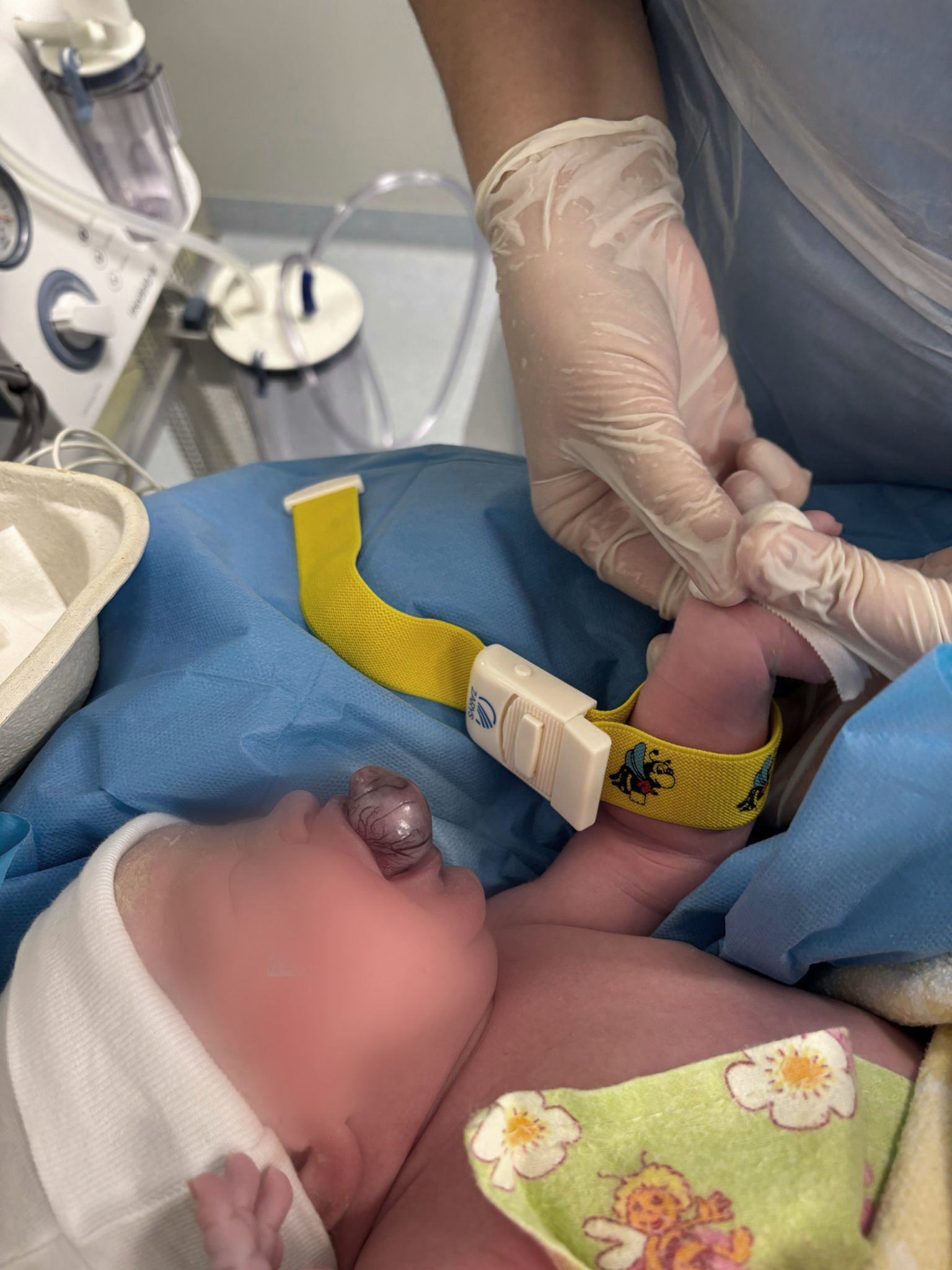 Bērnu slimnīcas un Stradiņa slimnīcas mediķi kopīgi operē jaundzimušo dažas minūtes pēc dzimšanas