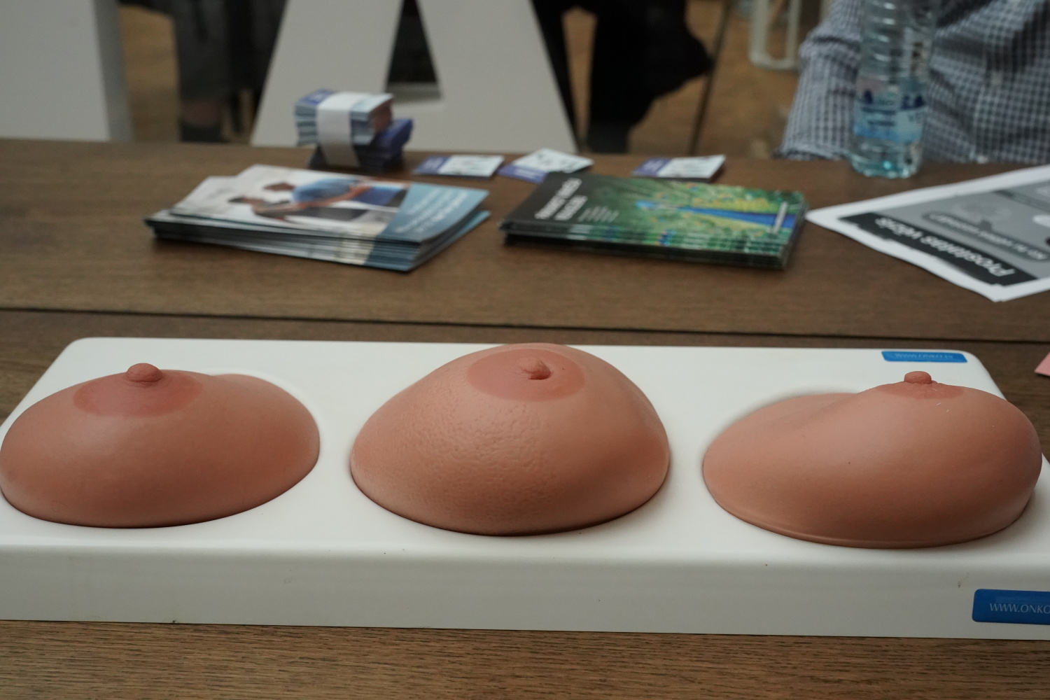 Vēzis Latvijā tiek atklāts vēlāk nekā Eiropā